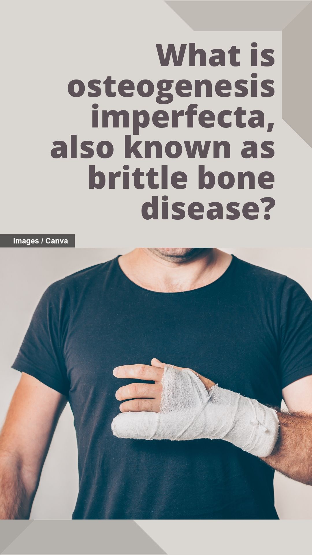 What is osteogenesis imperfecta, also known as brittle bone disease
