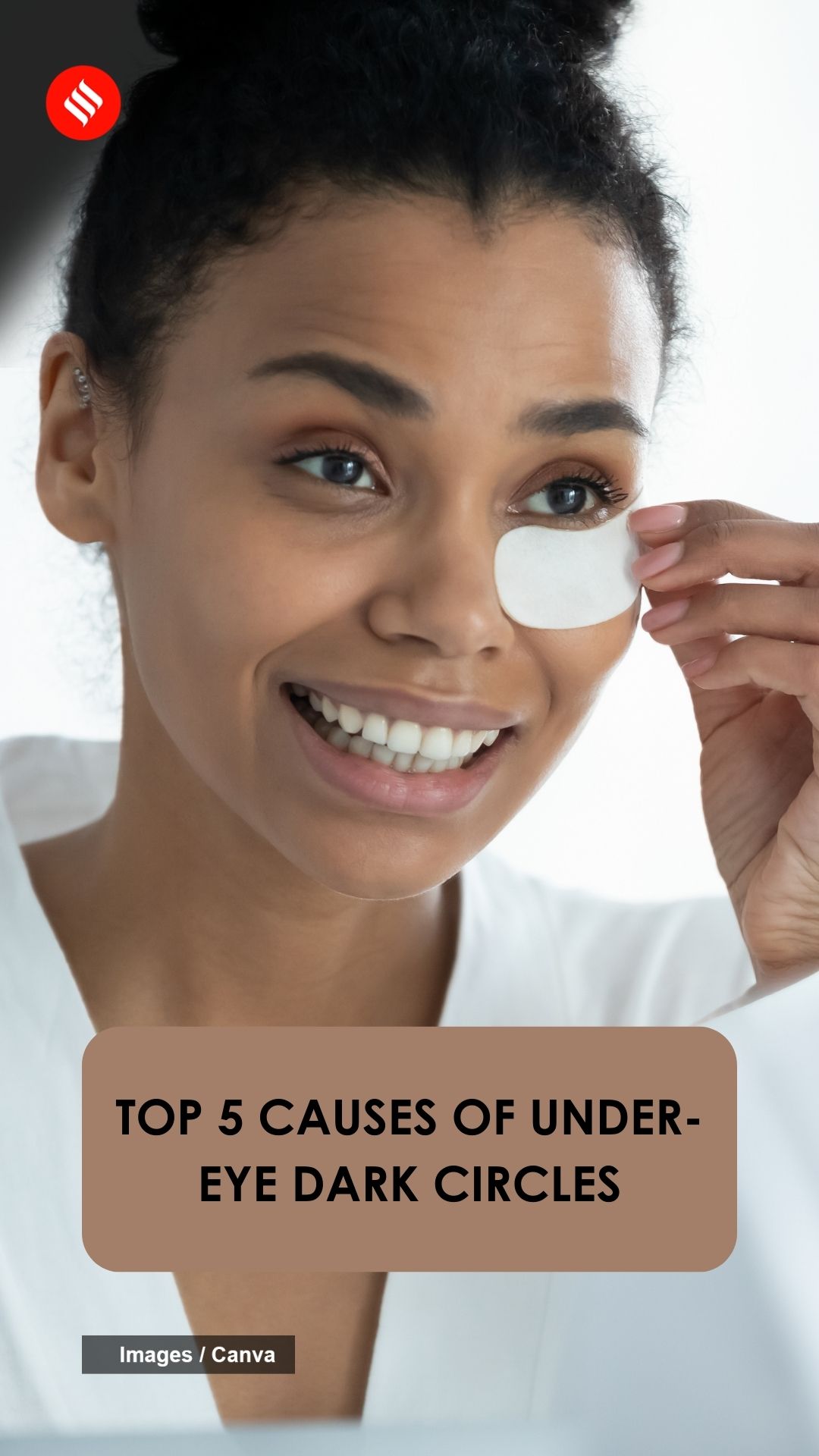 Top 5 causes of undereye dark circles The Indian Express