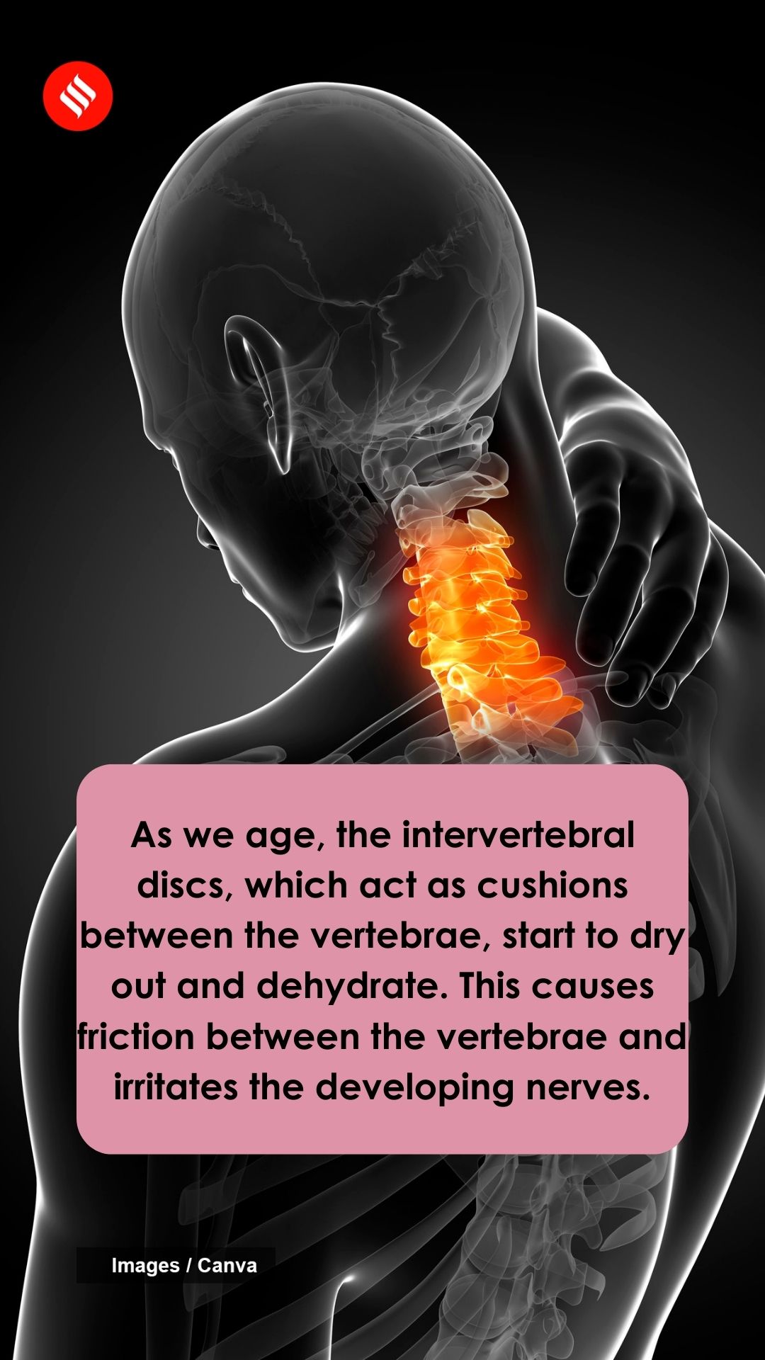 Ayurvedic remedies for neck pain The Indian Express